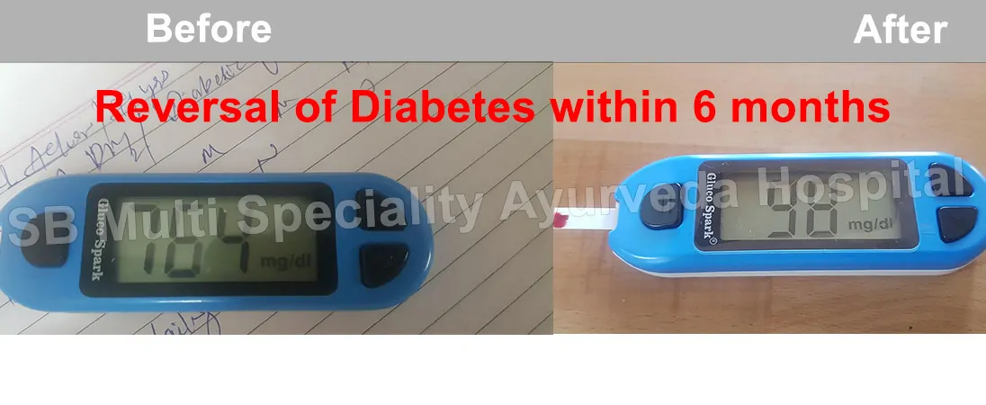 Sequence of clinical photographs labelled Before and After, showing blood sugar readings, before and after at successive stages of treatment.